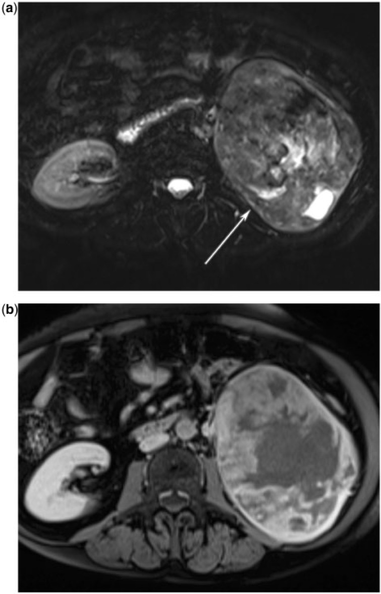 Figure 19