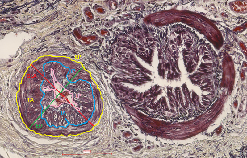 Fig 1