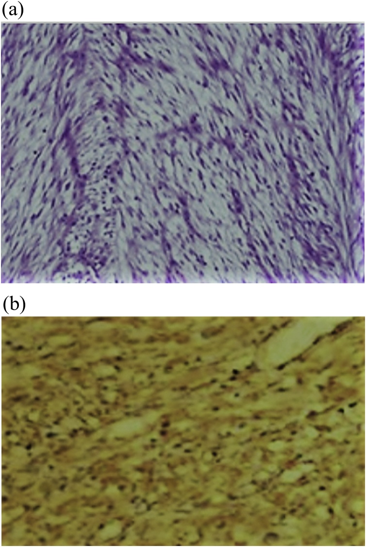 Fig. 5