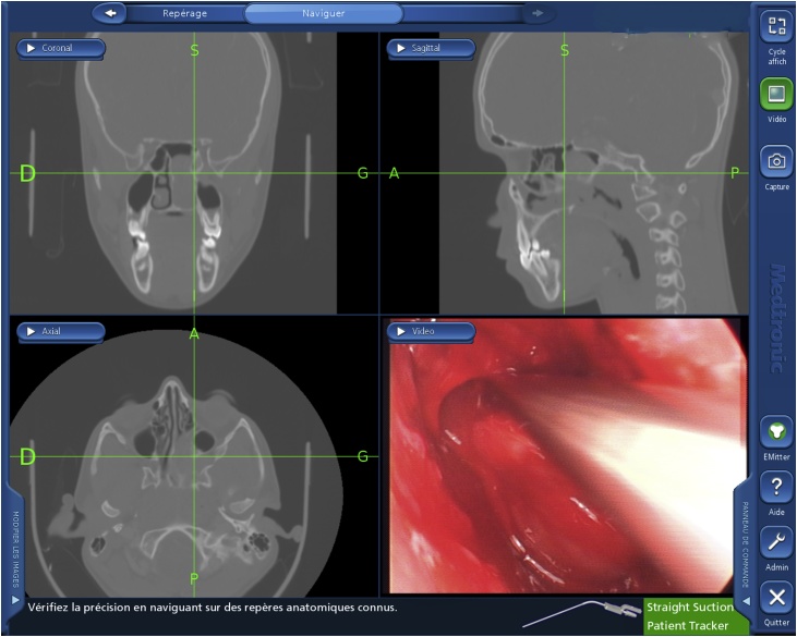 Fig. 4