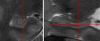 Figure 2b:
