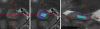 Figure 2c:
