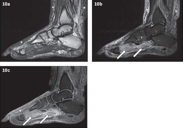 Fig. 10