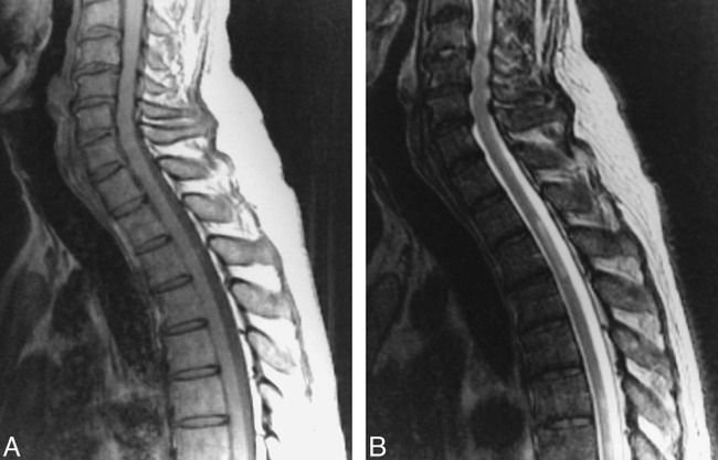 fig 3.