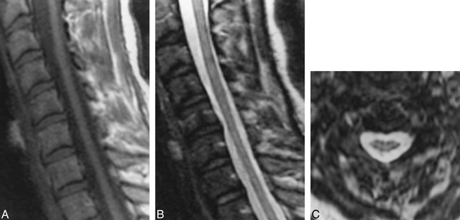 fig 2.