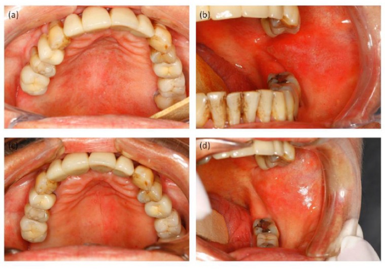 Fig. (2)