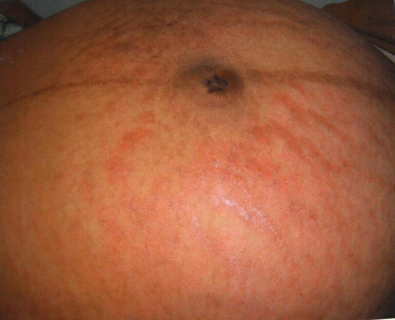 Fig. 5
