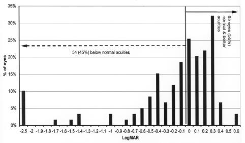 FIGURE 15