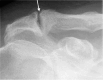 Fig. 6