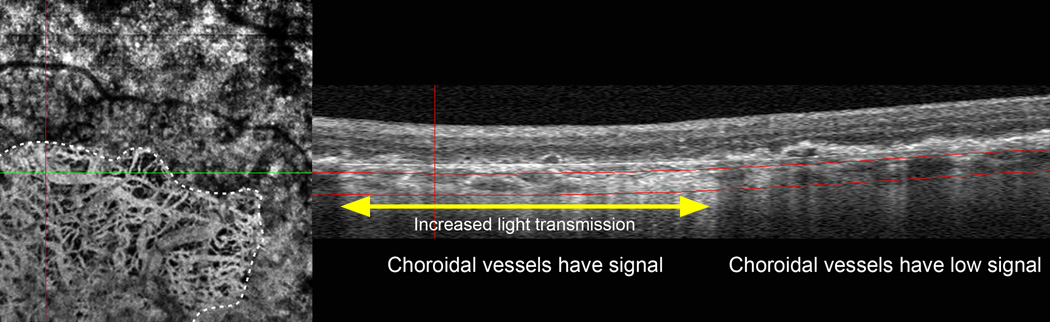 Figure 17