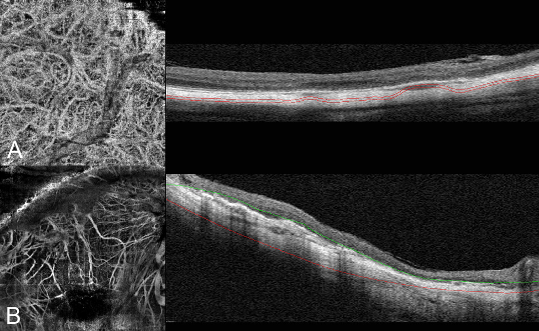 Figure 19