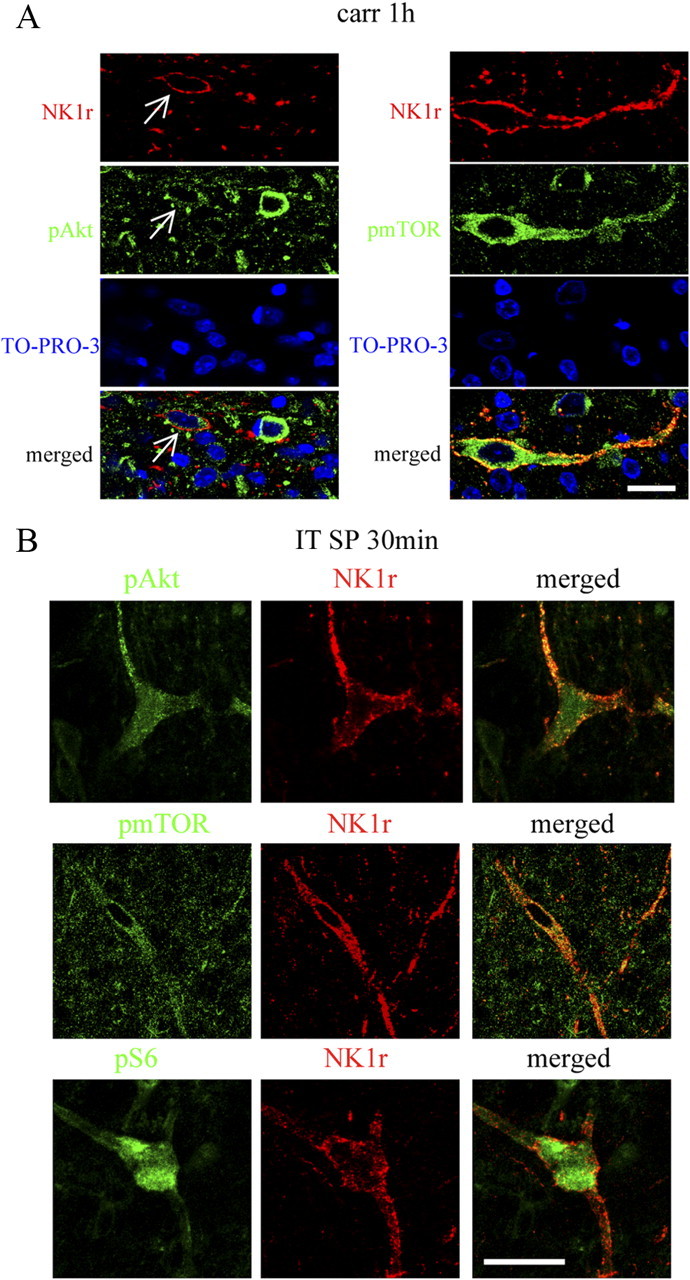 Figure 11.