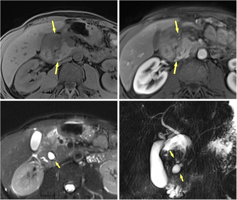 Fig. 13