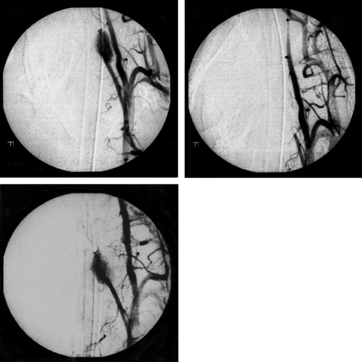 Fig 2.