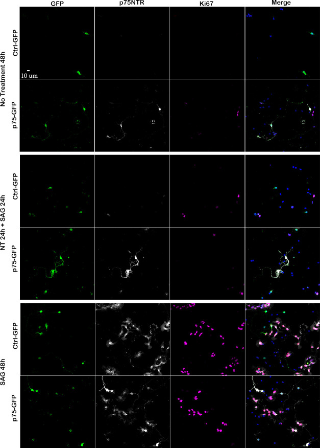 Figure 4—figure supplement 1.