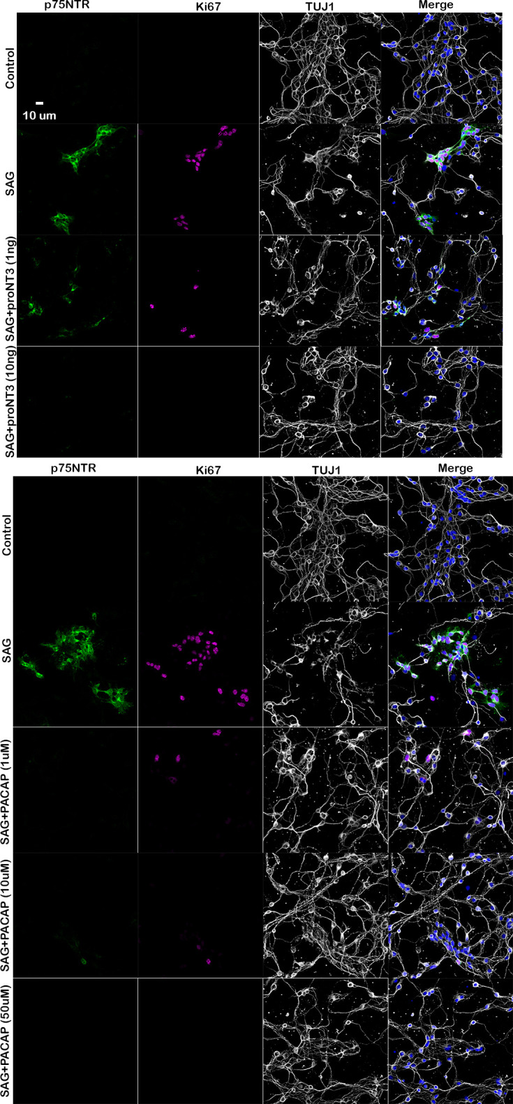 Figure 3—figure supplement 1.