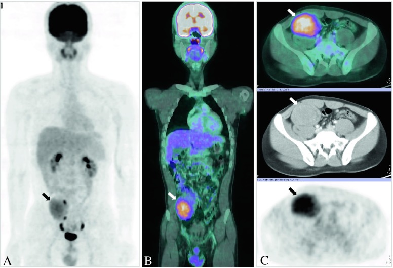 Fig. 3