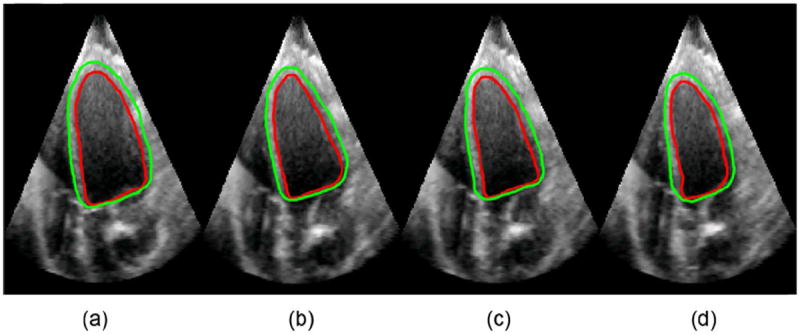 Fig. 12