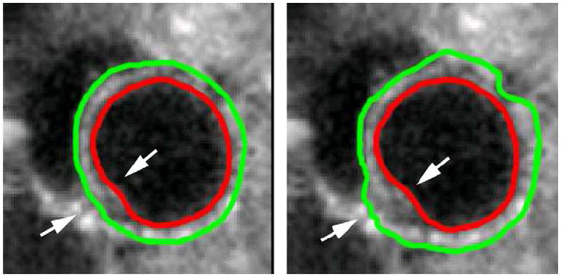 Fig. 14