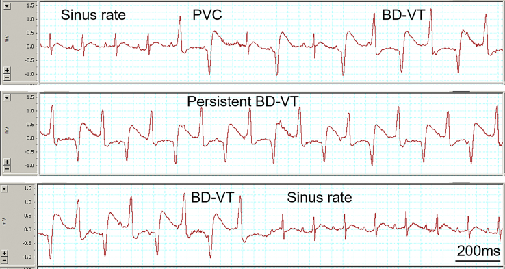 Figure 2