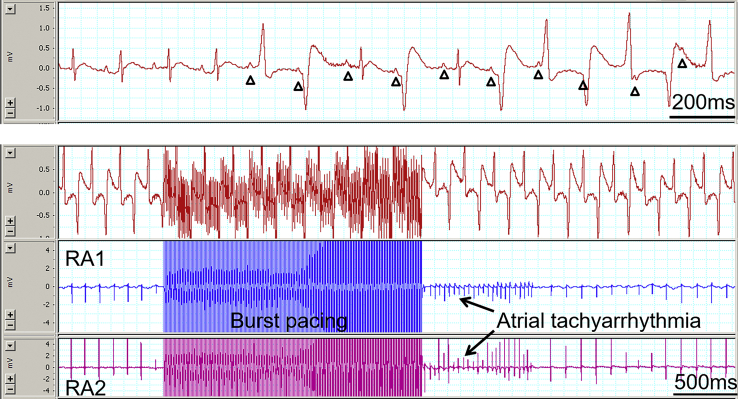 Figure 4