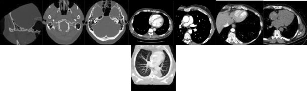 Fig. 8