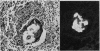 125