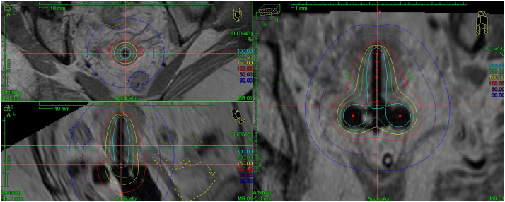 Fig. 3