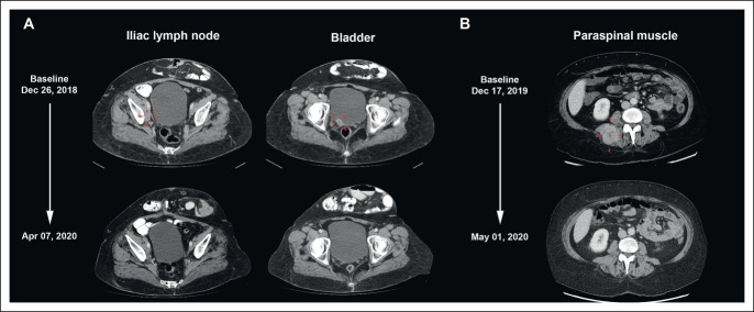 FIG 2.