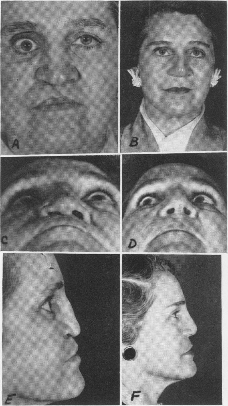 Fig. 6A, B, C, D, E, F.