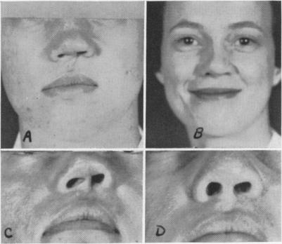 Fig. 5A, B, C, D.