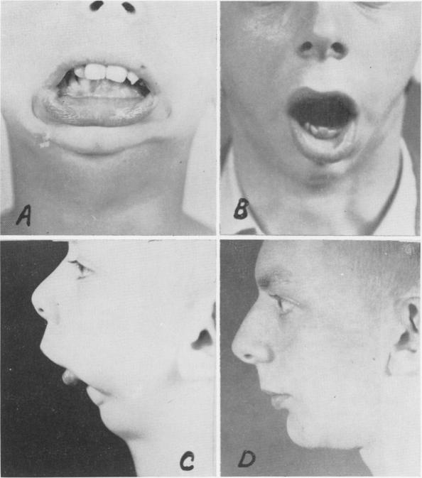 Fig. 2A, B, C, D.