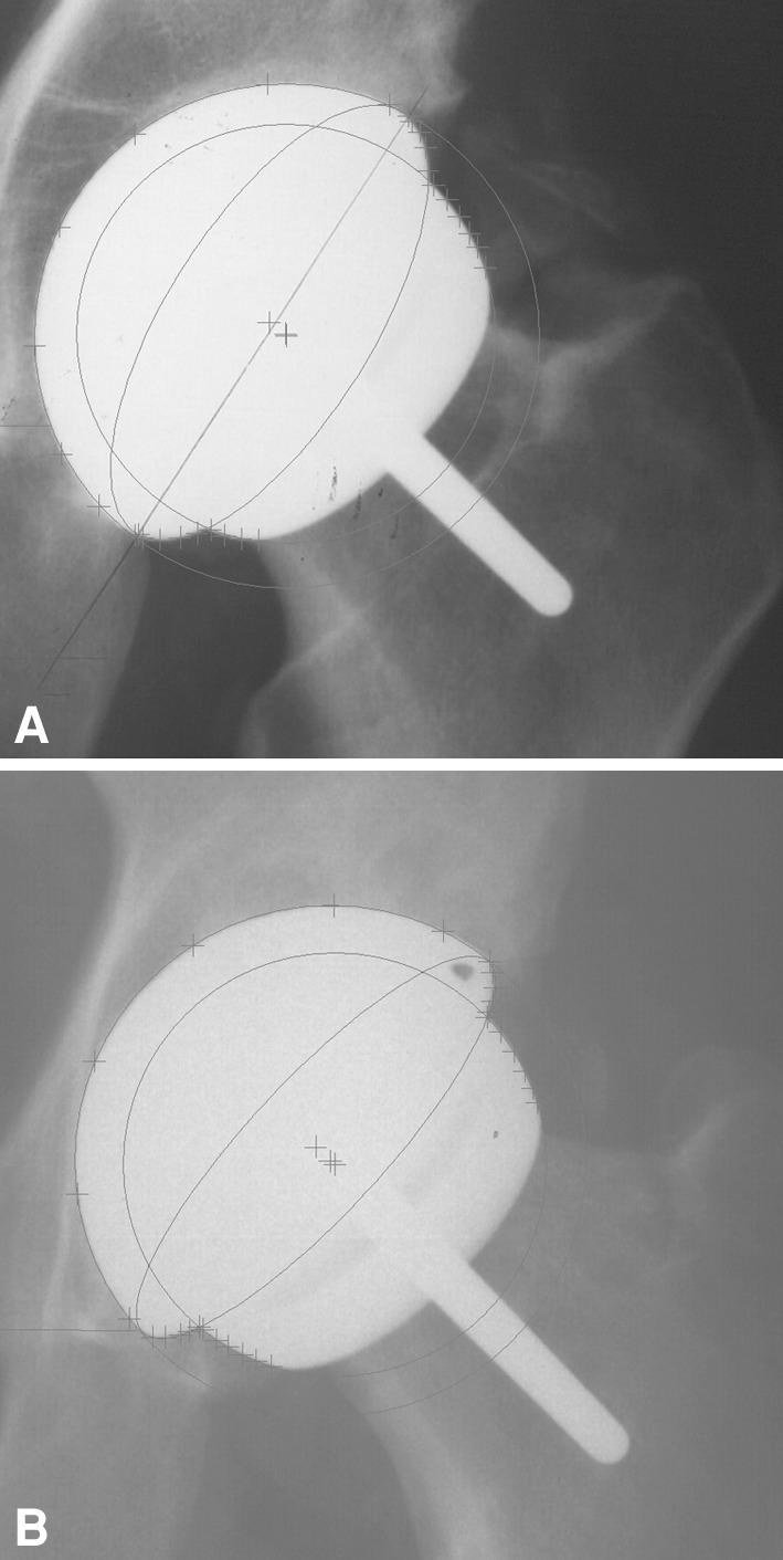 Fig. 1A–B