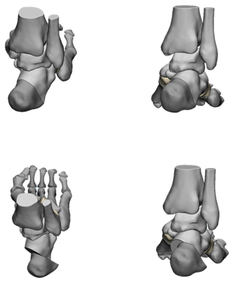 Figure 16