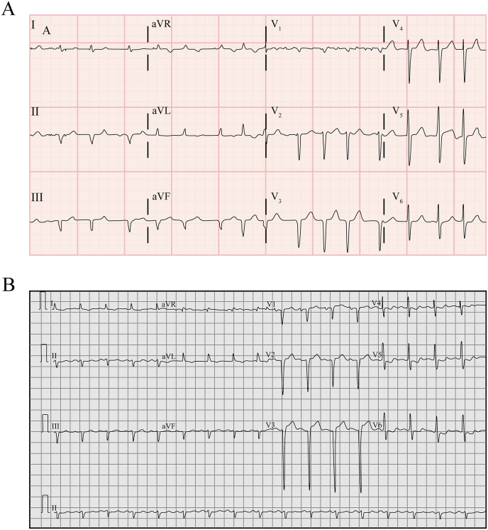 Fig. 3