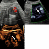 Fig. 6