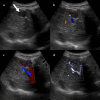 Fig. 2