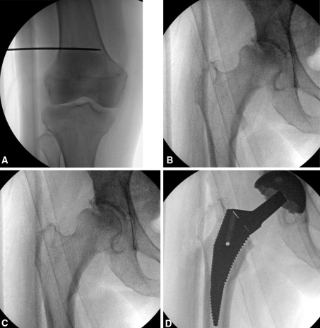 Fig. 2A–D