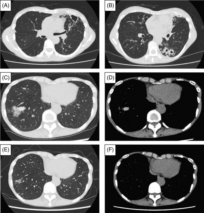 FIGURE 1