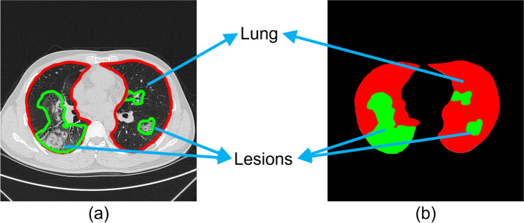 Fig. 2