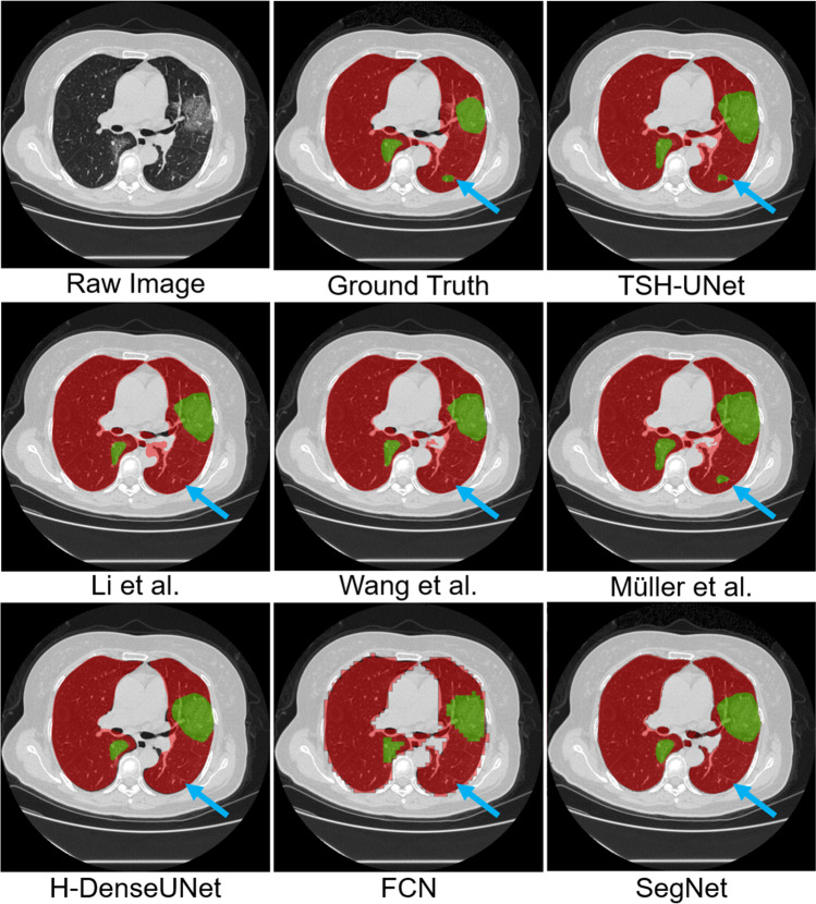 Fig. 3