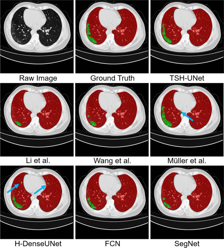 Fig. 4