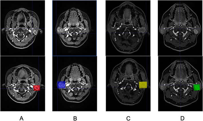 Fig. 1