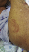 Fig. 3
