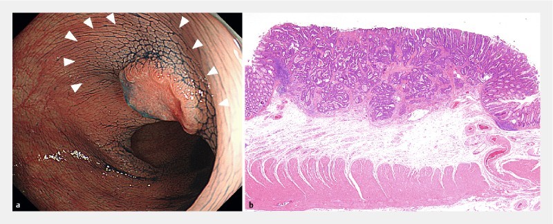 Fig. 3