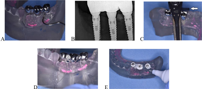 Fig. 4