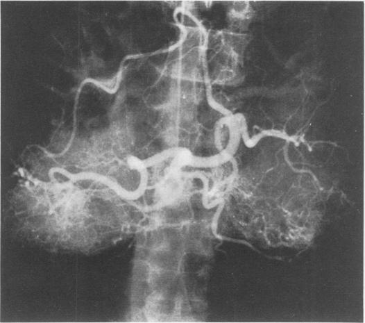 Fig. 1c.