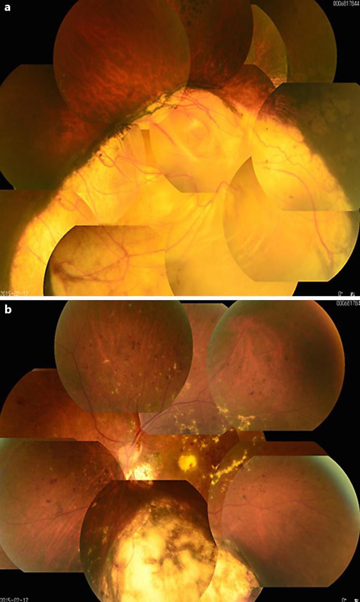 Fig. 1