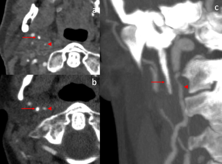 Fig. 4 –