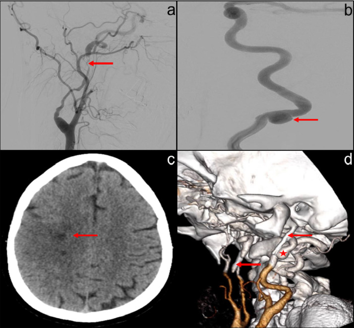 Fig. 1 –